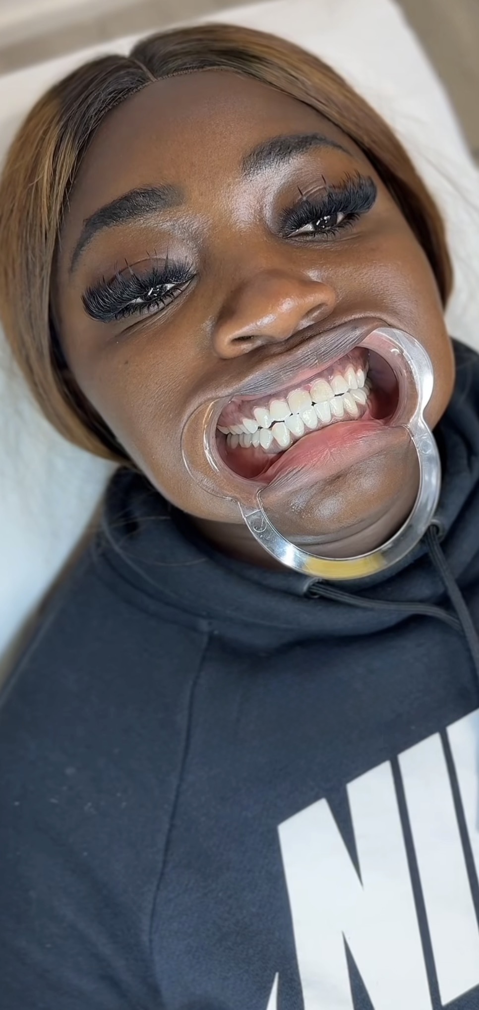 Professional Teeth Whitening studio work 3