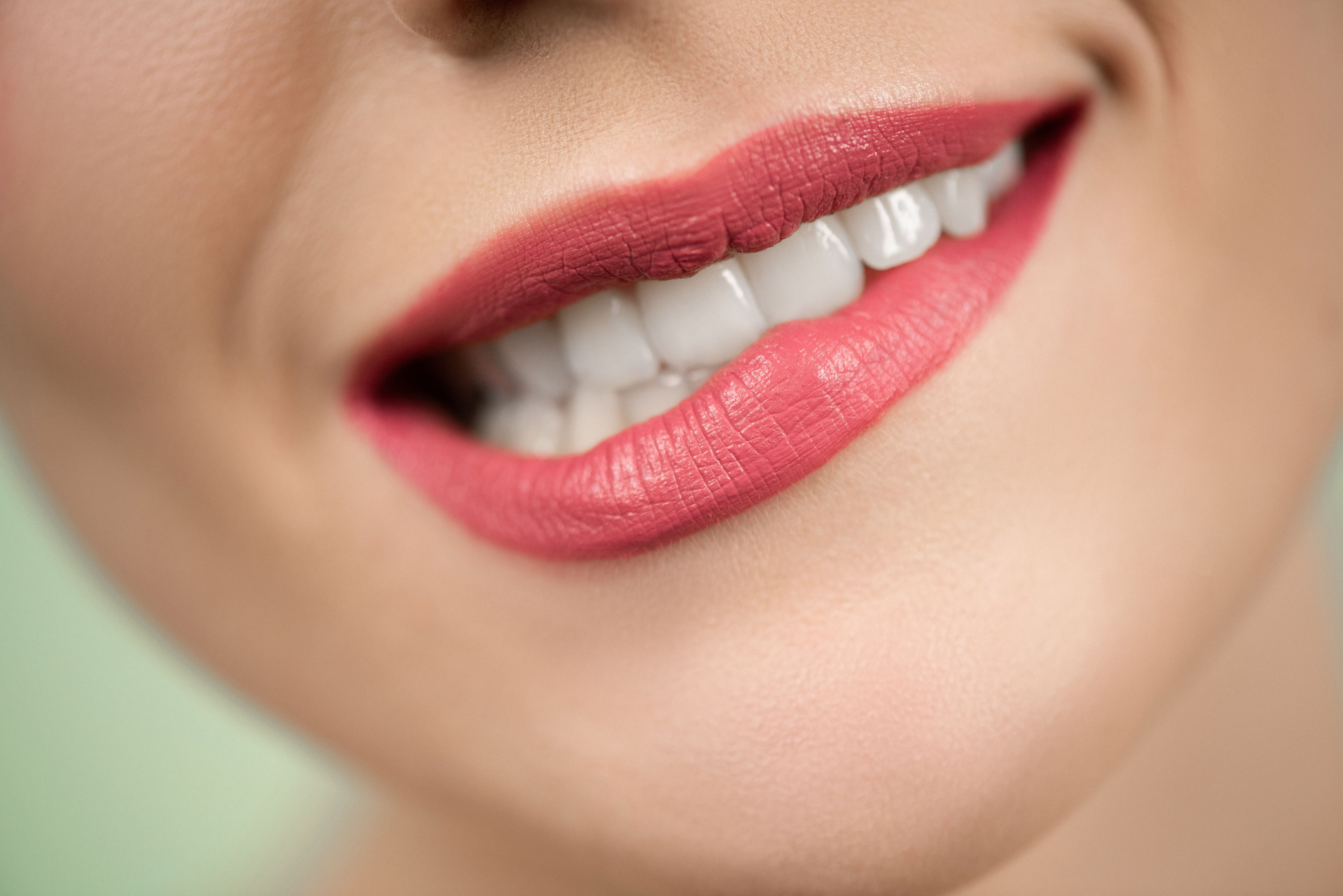 Professional teeth whitening result